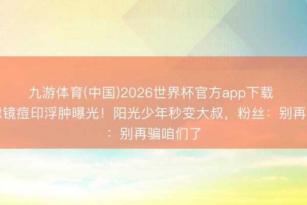 九游体育(中国)2026世界杯官方app下载 王源无滤镜痘印浮肿曝光!阳光少年秒变大叔,粉丝:别再骗咱们了